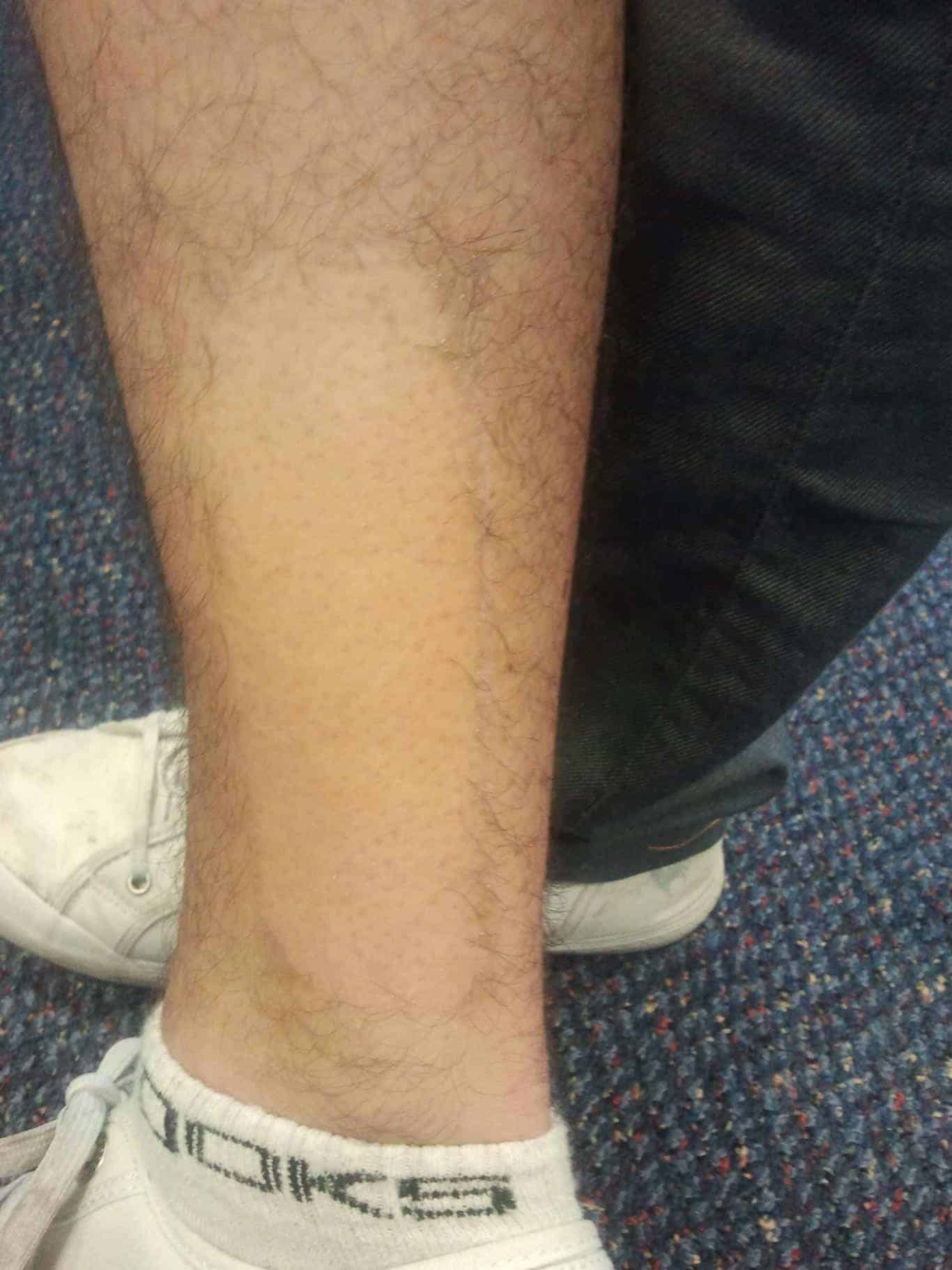 Closeup of man's hairy forearm
